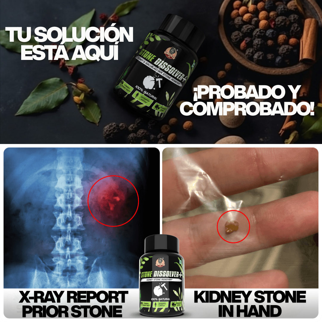 STONE DISSOLVER – La Fórmula Natural Que Disuelve Cálculos Renales y Vesiculares 🌿