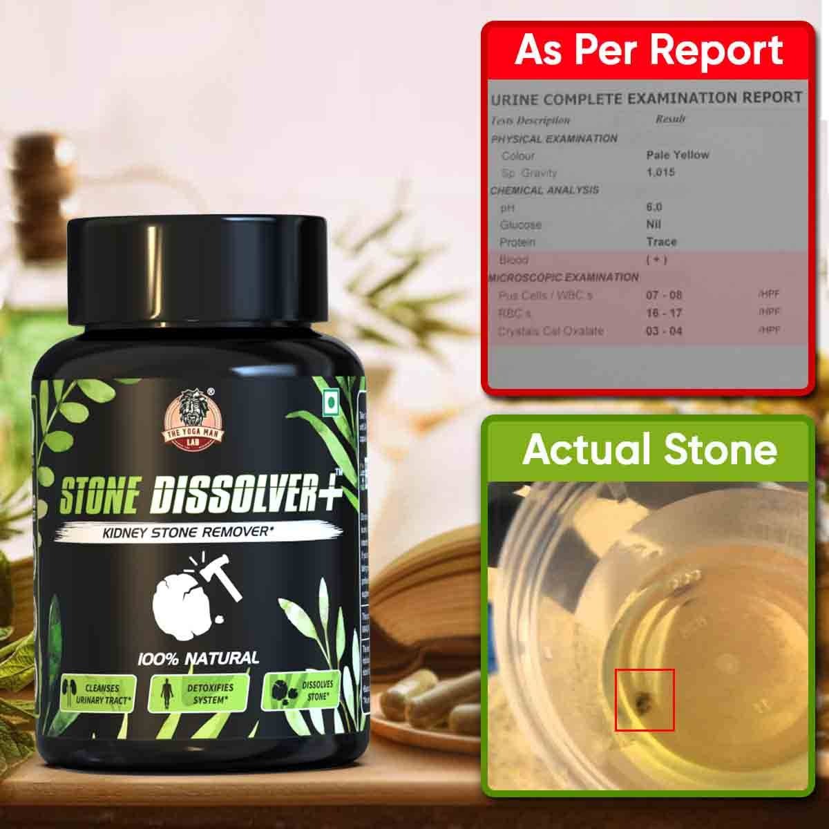 STONE DISSOLVER – La Fórmula Natural Que Disuelve Cálculos Renales y Vesiculares 🌿